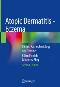 Imagen de portada: Atopic Dermatitis - Eczema 2nd edition 9783031124983