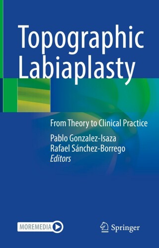 Cover image: Topographic Labiaplasty 9783031150470