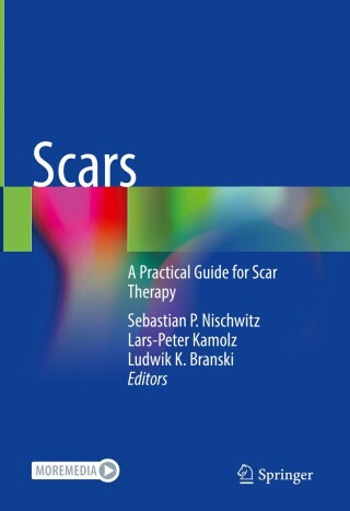 Imagen de portada: Scars 9783031241369