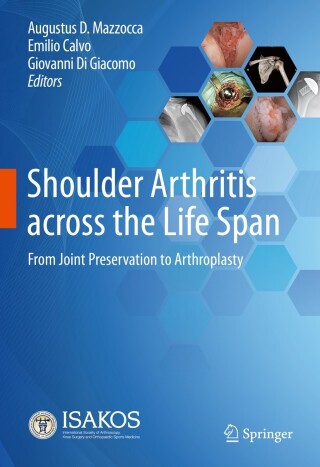 Imagen de portada: Shoulder Arthritis across the Life Span 9783031332975