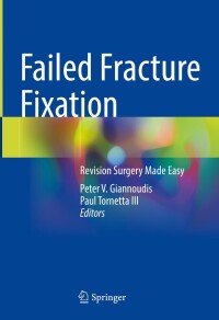 Cover image: Failed Fracture Fixation 1st edition 9783031396915