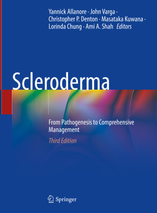Imagen de portada: Scleroderma 3rd edition 9783031406577