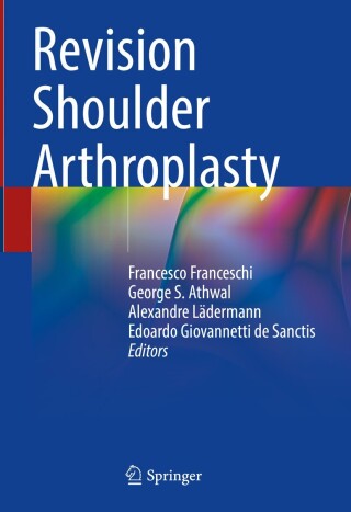 Imagen de portada: Revision Shoulder Arthroplasty 9783031459436
