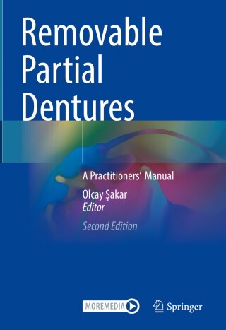 Cover image: Removable Partial Dentures 2nd edition 9783031470820