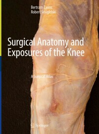 Imagen de portada: Surgical Anatomy and Exposures of the Knee 9783031476600