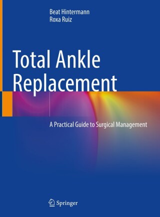 Imagen de portada: Total Ankle Replacement 9783031568091