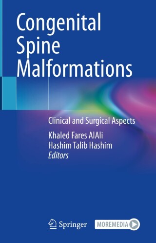 Imagen de portada: Congenital Spine Malformations 9783031590306