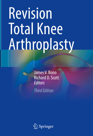 Imagen de portada: Revision Total Knee Arthroplasty 3rd edition 9783031619793
