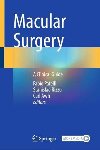 Imagen de portada: Macular Surgery 9783031635076