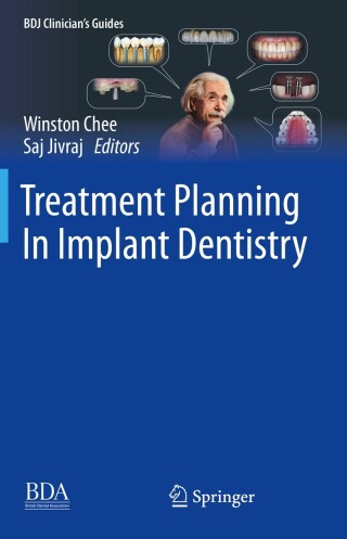 Cover image: Treatment Planning In Implant Dentistry 2nd edition 9783031687259