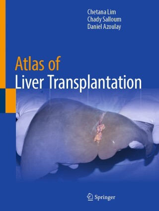 Cover image: Atlas of Liver Transplantation 9783031852633