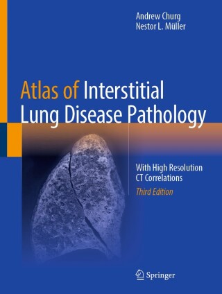 Cover image: Atlas of Interstitial Lung Disease Pathology 3rd edition 9783031859663
