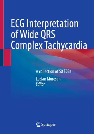 Imagen de portada: ECG Interpretation of Wide QRS Complex Tachycardia 9783031970290