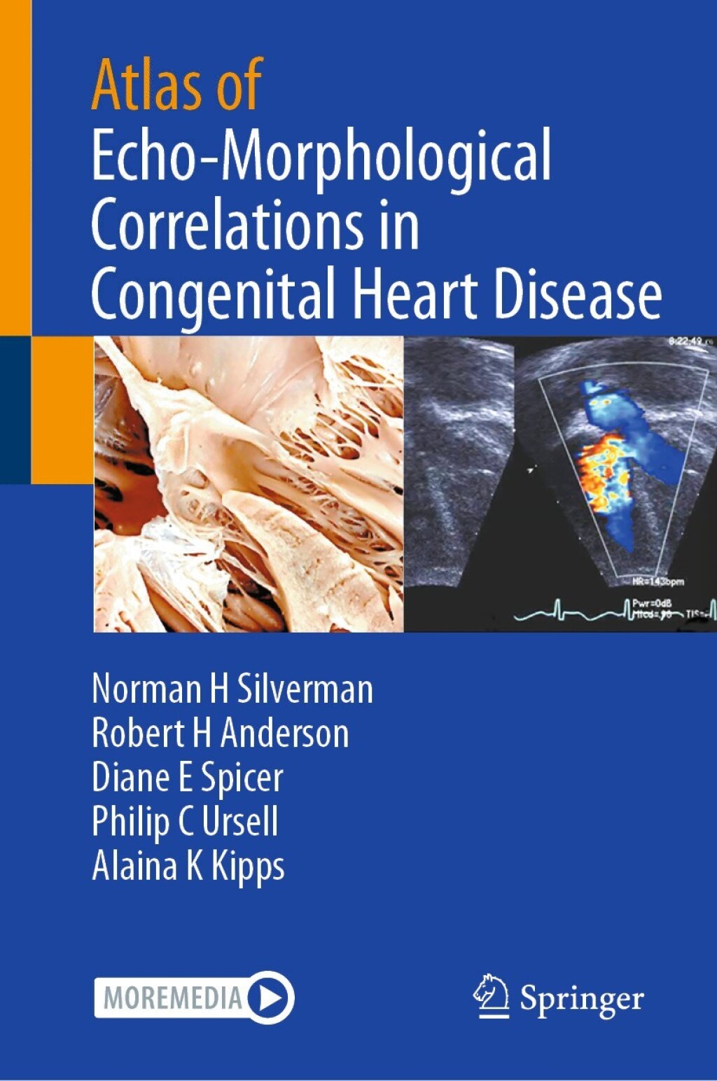 ISBN 9783032005403 product image for Atlas of Echo-Morphological Correlations in Congenital Heart Disease (eBook Rent | upcitemdb.com