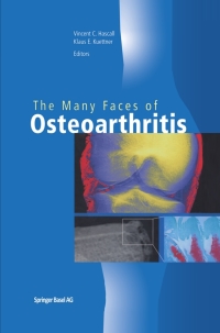 صورة الغلاف: The Many Faces of Osteoarthritis 1st edition 9783764365813