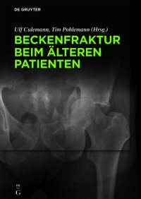 Cover image: Beckenfraktur beim älteren Patienten 1st edition 9783110426489