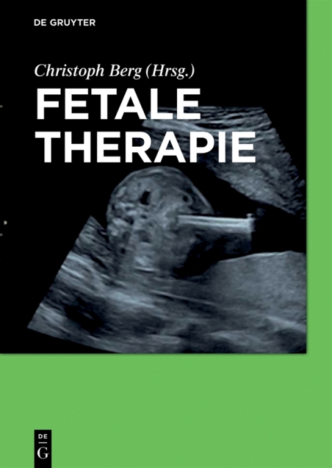 Fetale Therapie, 1st Edition - FULL INSTANT DOWNLOAD | PDF DOCX EPUB
