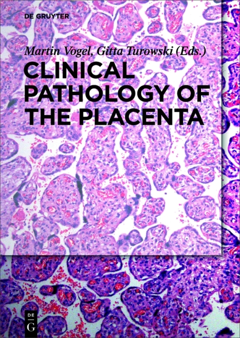 Clinical Pathology of the Placenta, 1st Edition - FULL INSTANT DOWNLOAD | PDF DOCX EPUB