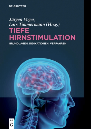 Cover image: Tiefe Hirnstimulation 1st edition 9783110458763