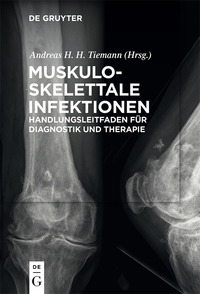 Cover image: Muskuloskelettale Infektionen 1st edition 9783110473155