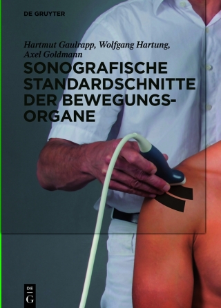 Cover image: Sonografische Standardschnitte der Bewegungsorgane 1st edition 9783110534566