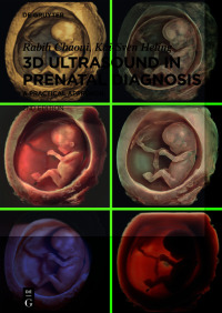 Cover image: 3D Ultrasound in Prenatal Diagnosis 2nd edition 9783111249094