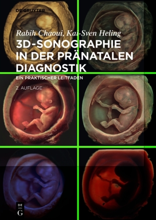 Cover image: 3D-Sonographie in der pränatalen Diagnostik 2nd edition 9783111251448