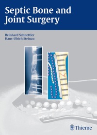 Cover image: Septic Bone and Joint Surgery 1st edition 9783131490315