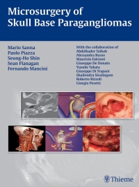 Immagine di copertina: Microsurgery of Skull Base Paragangliomas 1st edition 9783131486110