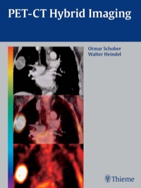 Cover image: PET-CT Hybrid Imaging 1st edition 9783131488619