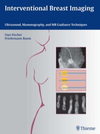 Immagine di copertina: Interventional Breast Imaging 1st edition 9783131467010