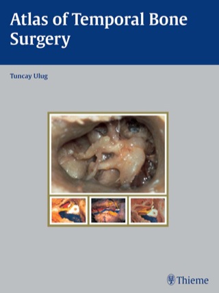 Cover image: Atlas of Temporal Bone Surgery 1st edition 9783131471512