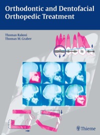 表紙画像: Orthodontic and Dentofacial Orthopedic Treatment 1st edition 9783131277619