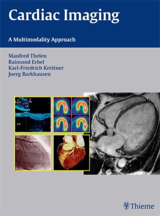 Cover image: Cardiac Imaging 1st edition 9783131477811