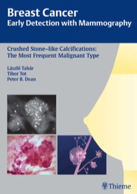 表紙画像: Breast Cancer: Early Detection with Mammography 1st edition 9783131485311