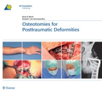 Cover image: Osteotomies for Posttraumatic Deformities 1st edition 9783131486714