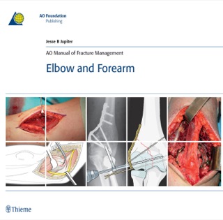 Cover image: AO Manual of Fracture Management - Elbow and Forearm 1st edition 9783131492715