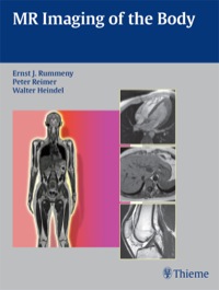 表紙画像: MR Imaging of the Body 1st edition 9783131358417