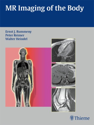 Imagen de portada: MR Imaging of the Body 1st edition 9783131358417