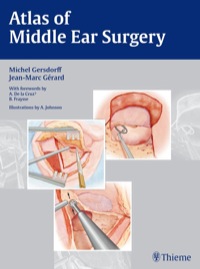 Cover image: Atlas of Middle Ear Surgery 1st edition 9783131450418