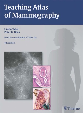 Omslagafbeelding: Teaching Atlas of Mammography 4th edition 9783136408049
