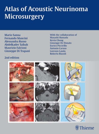 Imagen de portada: Atlas of Acoustic Neurinoma Microsurgery 2nd edition 9783131102829