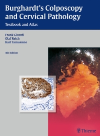 Cover image: Burghardt's Colposcopy and Cervical Pathology 4th edition 9783136599044