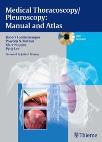 Cover image: Medical Thoracoscopy / Pleuroscopy: Manual and Atlas 1st edition 9783131082213