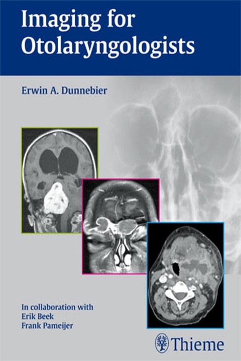 Imaging for Otolaryngologists, 1st  Edition - FULL INSTANT DOWNLOAD | PDF DOCX EPUB