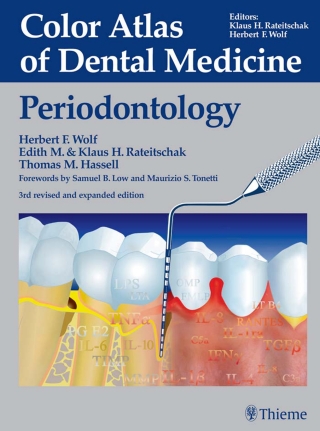 Cover image: Color Atlas of Dental Medicine: Periodontology 3rd edition 9783136750032
