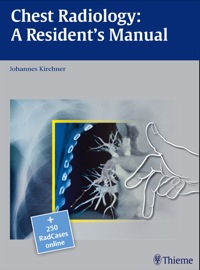 Titelbild: Chest Radiology: A Resident's Manual 1st edition 9783131538710