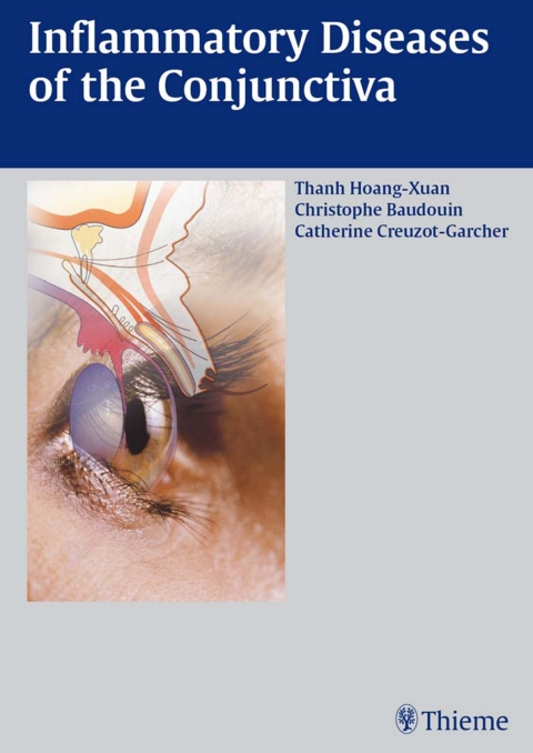 Inflammatory Diseases of the Conjuctiva, 1st  Edition - FULL INSTANT DOWNLOAD | PDF DOCX EPUB