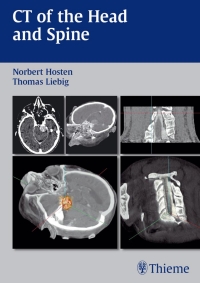 表紙画像: CT of the Head and Spine 1st edition 9783131267115