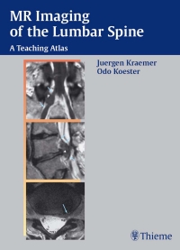 Cover image: MR Imaging of the Lumbar Spine 1st edition 9783131300911